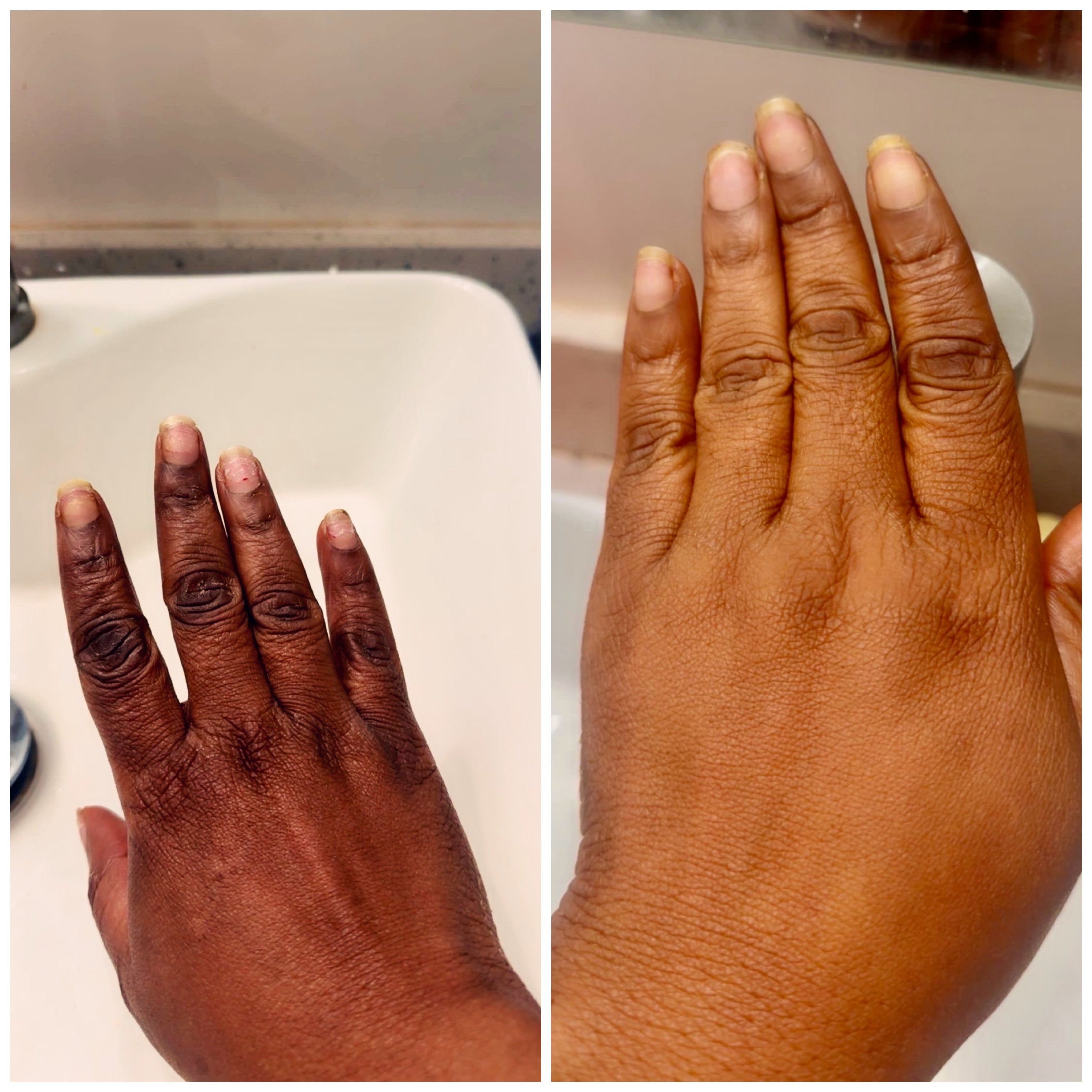 nuckles gel