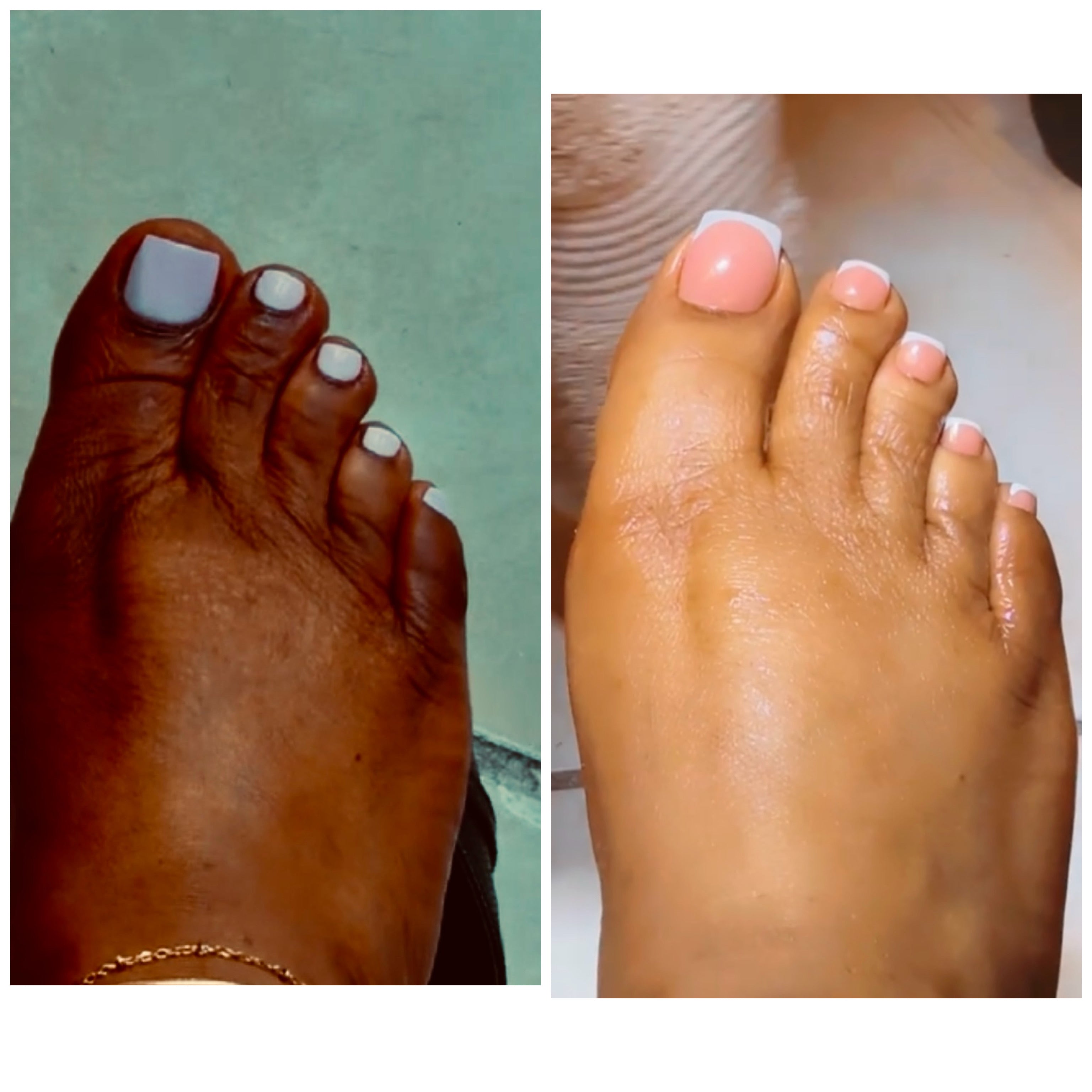 nuckles gel